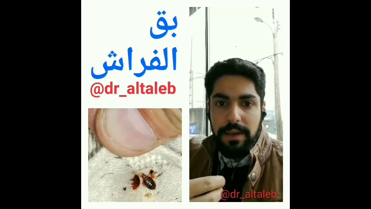 انقل لك تجربتي في التخلص من البق حشره الفراش