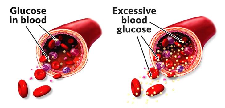 كيفية المحافظة على معدل السكر الطبيعي للجسم - ما نسبه السكر فى الدم 4995 1